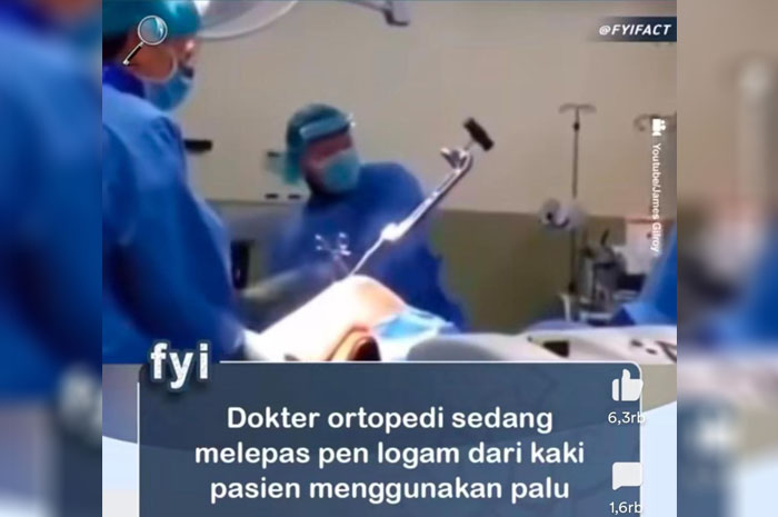Merinding! Doktor Ortopedi Sedang Lepas Pen Logam di Kaki Pasien Menggunakan Palu