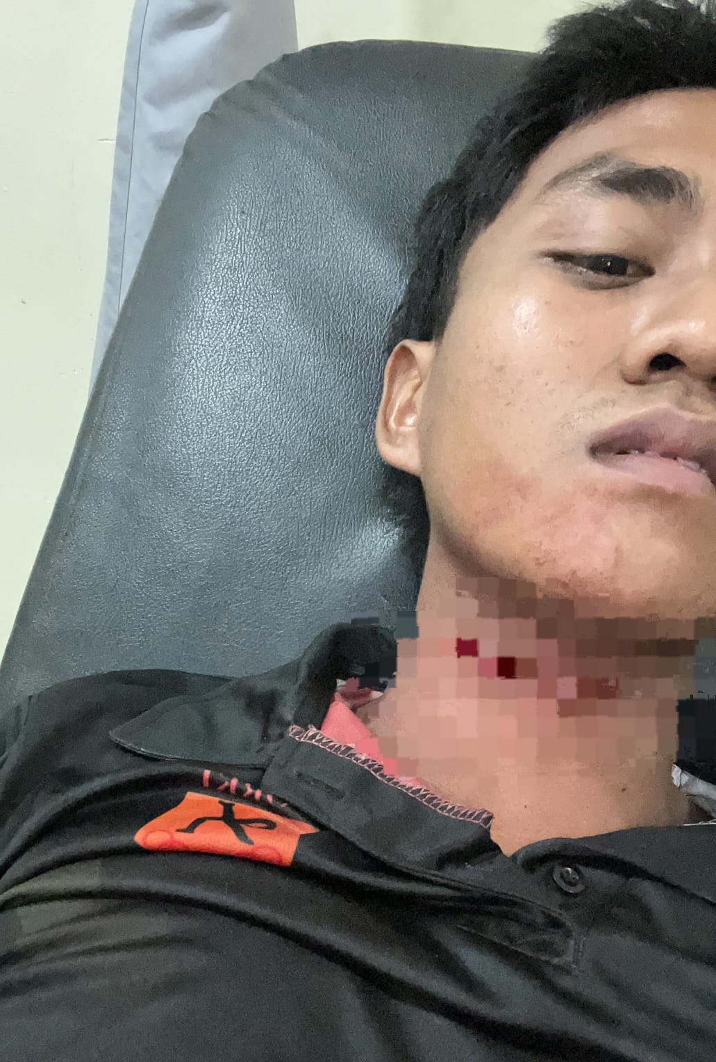 Leher Kena Tali Layangan Melintas di Jembatan Musi VI Palembang, Atlet Karate Butuh Donatur Biaya Operasi