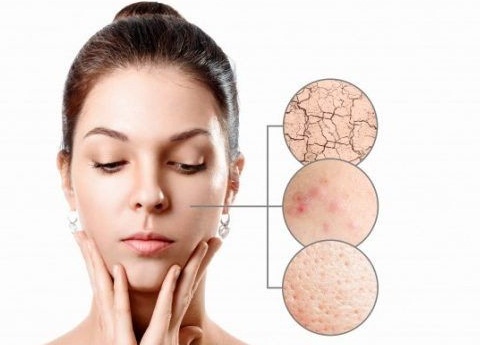 Mari kita pelajari 5 tanda produk perawatan kulit tidak cocok digunakan pada wajah