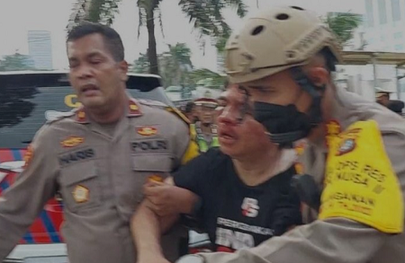 Ade Armando Alami Pendarahan Kandung Kemih dan Pendarahan Otak