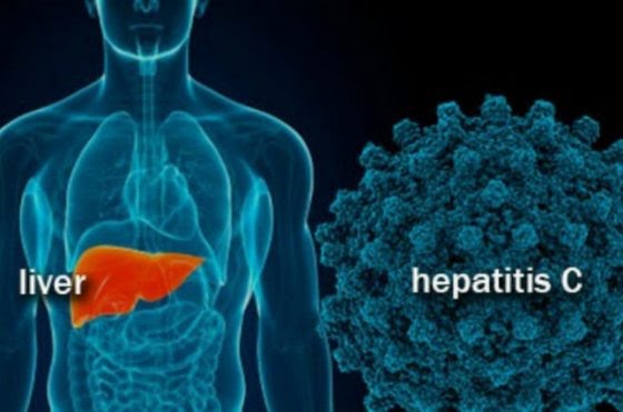 3 Anak Meninggal karena Hepatitis Misterius, Ini Gejalanya