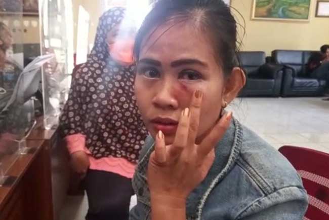 Minta Uang Bayar Ledeng, Suami Aniaya Istri Siri