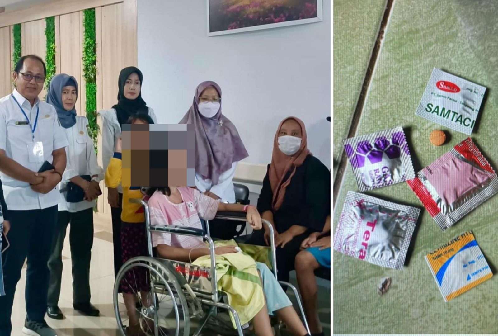 Makan 6 Macam Obat dari Oknum Bidan, Bola Mata Bocah SMP di Palembang Nyaris Lepas, Korban Malapraktik?