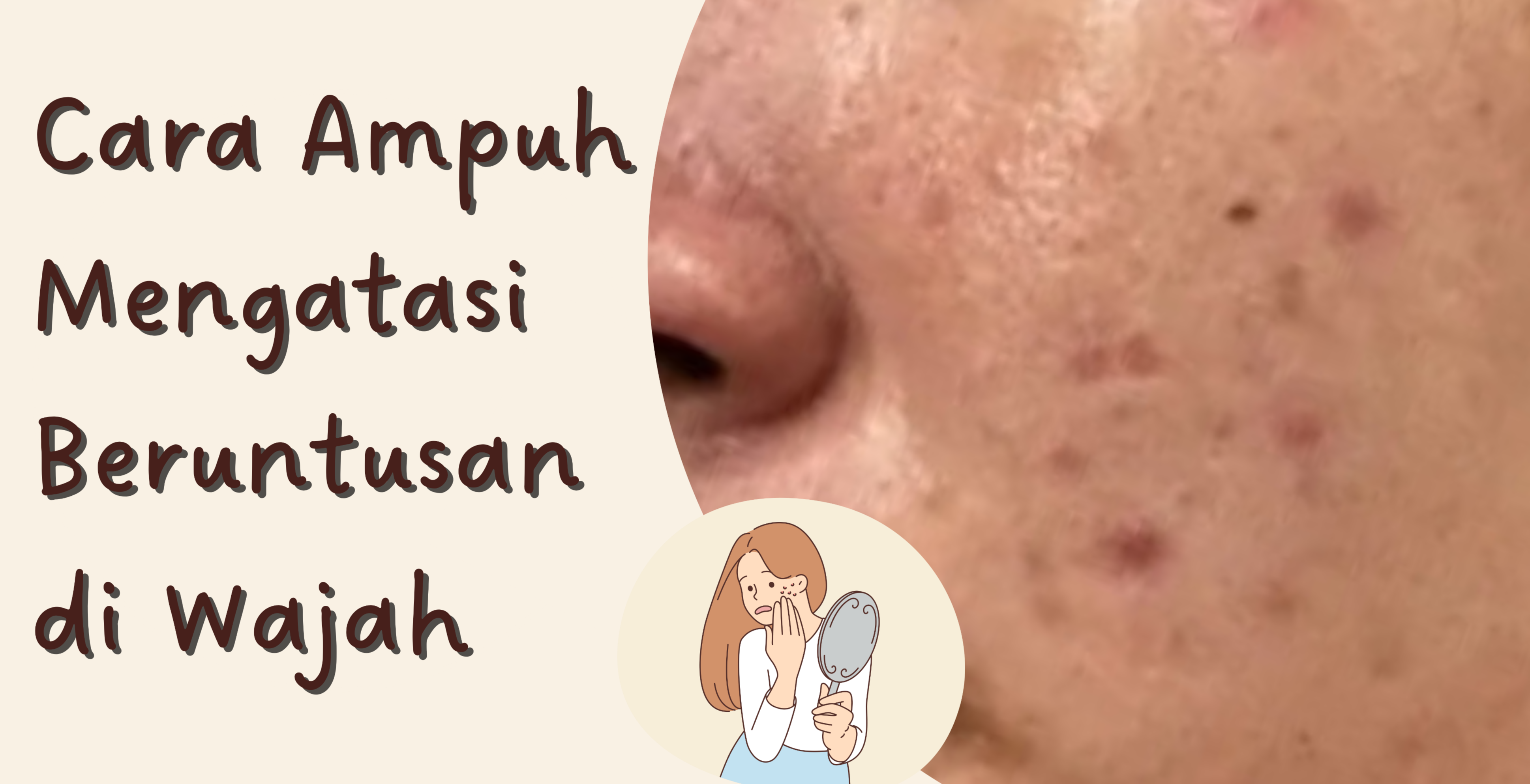 Begini Cara Atasi Bruntusan pada Wajah Secepat Kilat, Tips dan Trik Ampuh!