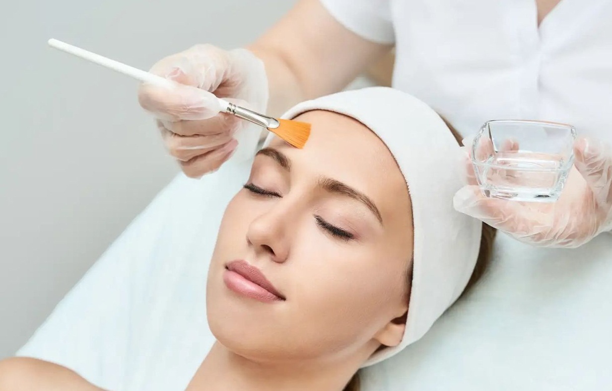 Wajib Diketahui! 6 Tips Larangan Setelah Treatment Chemical Peeling Agar Tidak Muncul Efek Samping