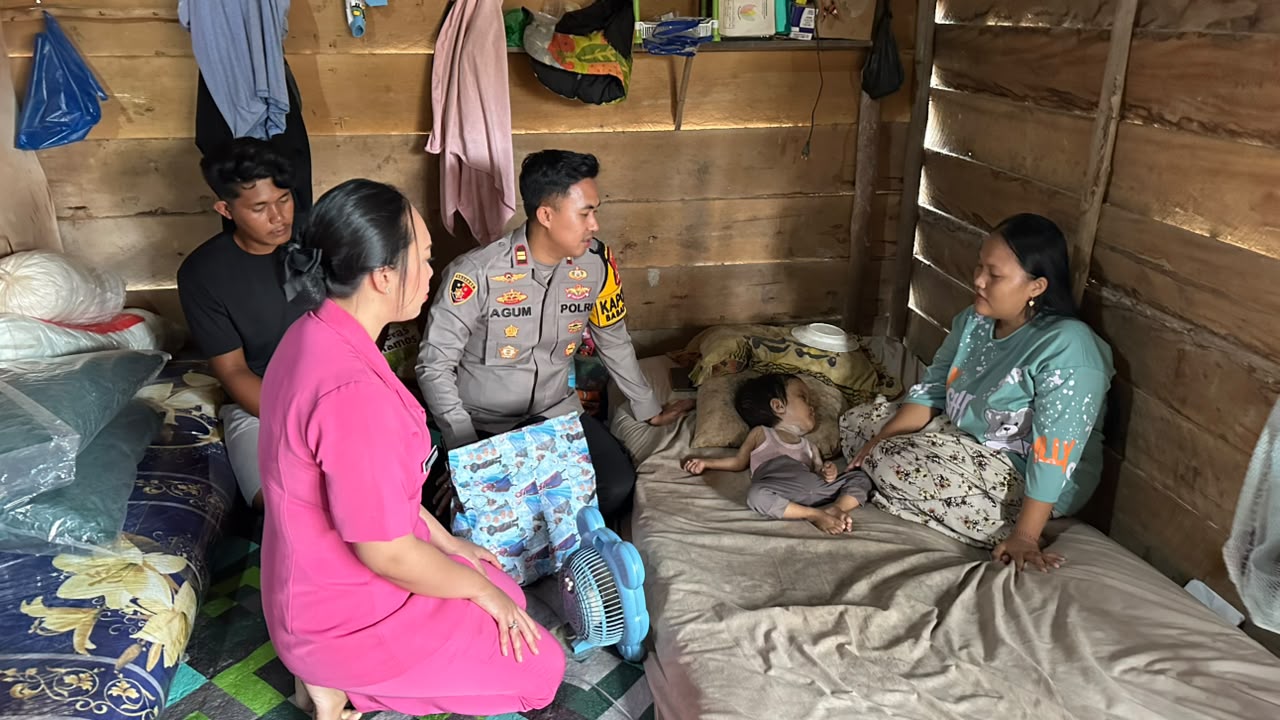 Menyentuh Hati, Polsek Babat Supat Bantu Anak Penderita Hidrosefalus Jelang Hari Bhayangkara ke-80