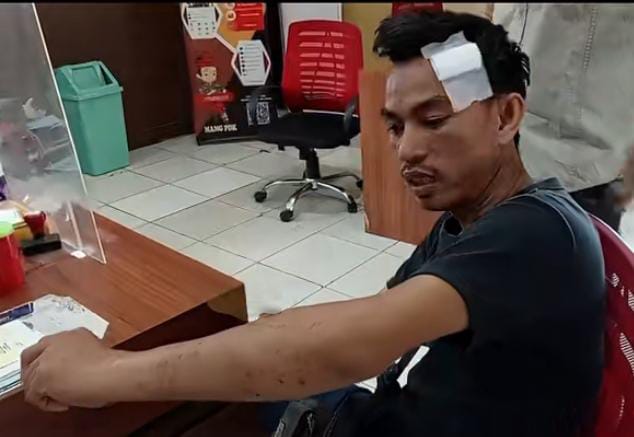 Dituduh Curi Narkoba, DJ di Kampung Baru Disekap dan Dikeroyok 