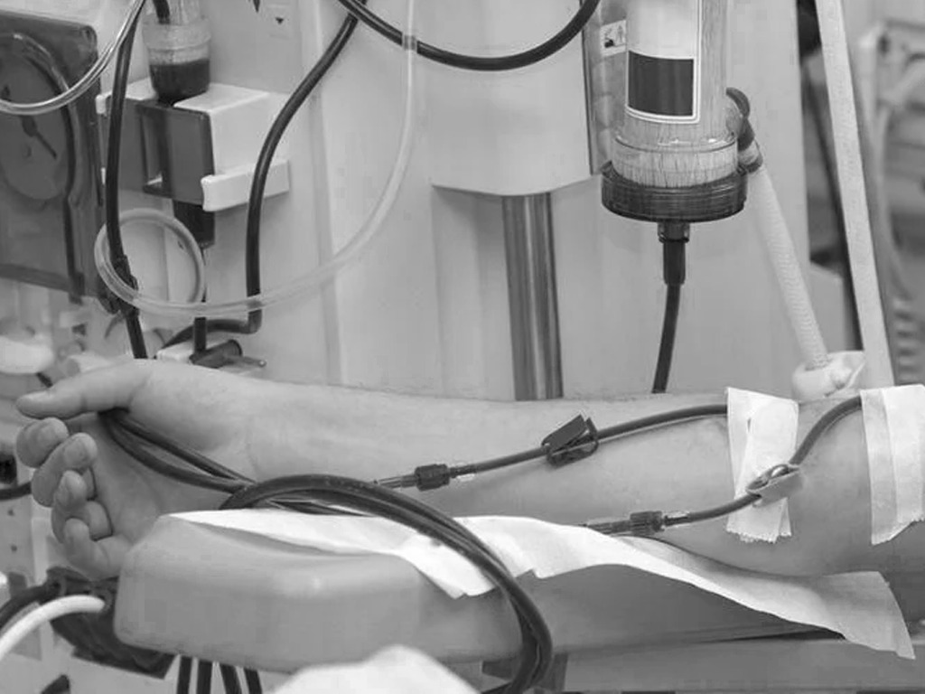 Pasien Gagal Ginjal Bisa Gunakan BPJS Kesehatan untuk Cuci Darah di Rumah Sakit 