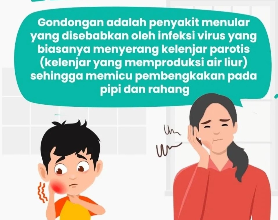 Kenali Gejala dan Penyebab Gondongan, Ternyata Penyakit Menular dan Perlu Diwaspadai