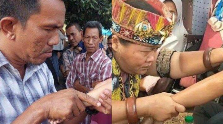  Wow...Setelah Heboh Ida Dayak, Kini Pengobatan Tradisional Bang Man Asal Aceh Jadi Sorotan Media Sosial