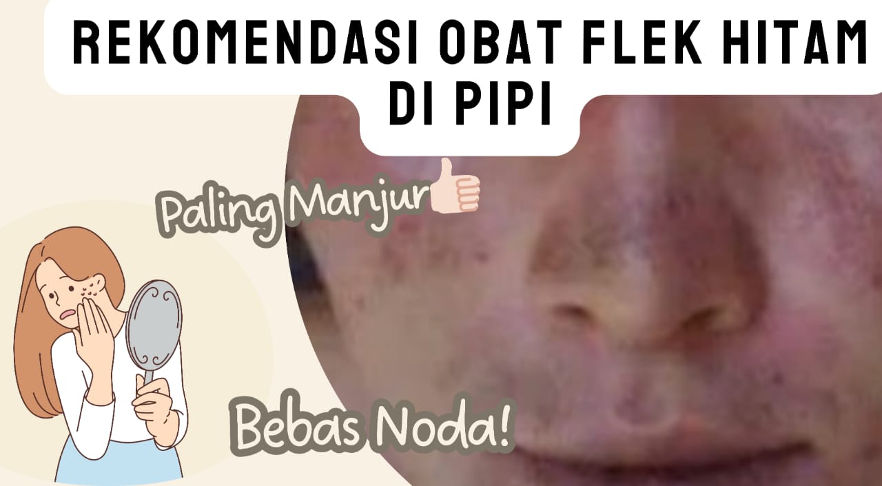 Pipi Bebas Noda! Berikut Rekomendasi Obat Flek Hitam Paling Manjur Bikin Wajah Mulus