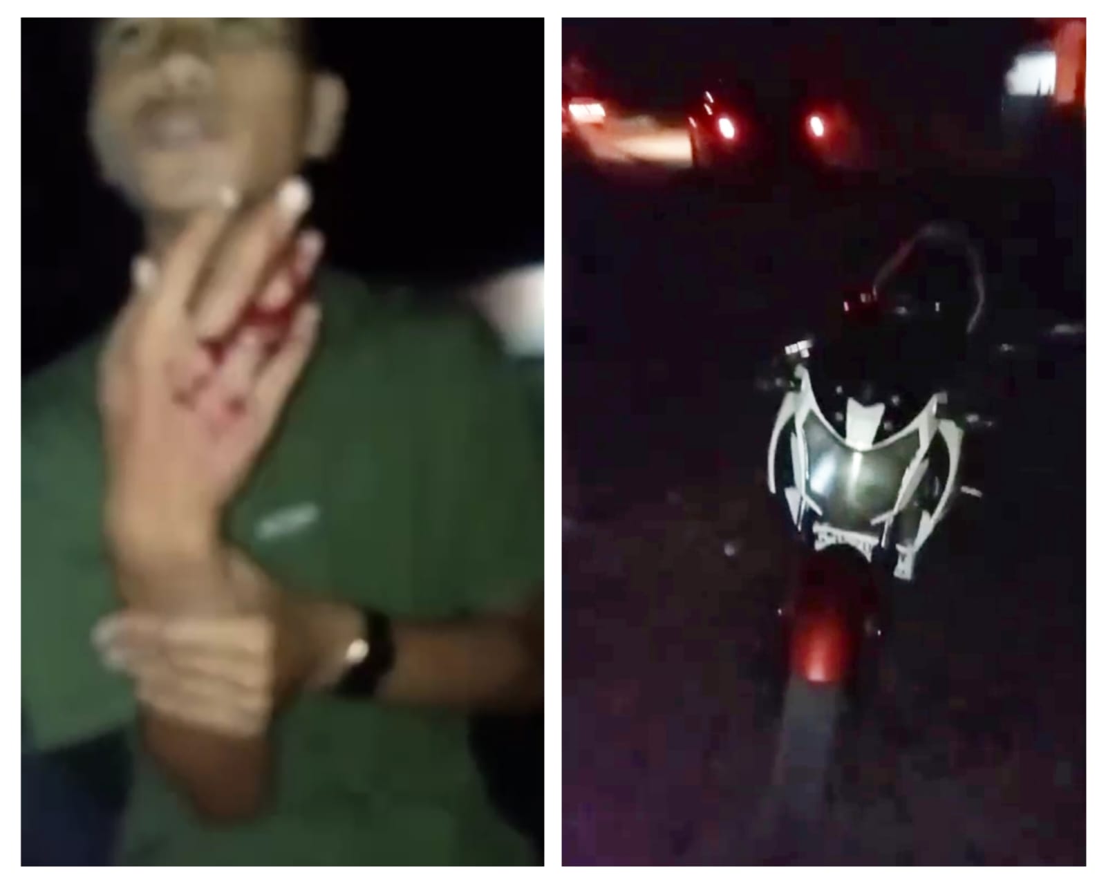 Jalan Rusak di Tanjung Batu Ogan Ilir Makan Korban, Pengendara Motor Kecelakaan Tunggal, Jari Manis Putus