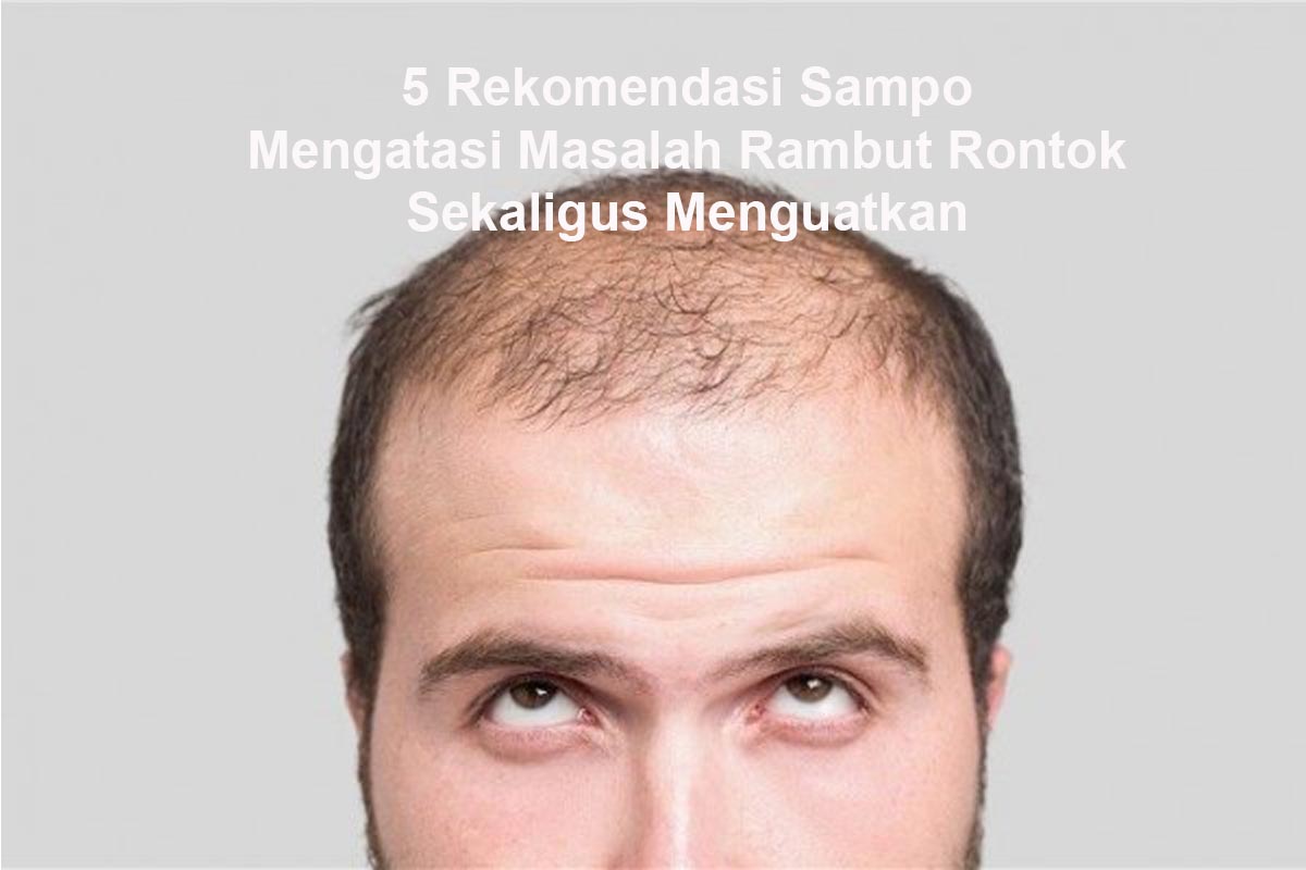  Ini 5 Rekomendasi Sampo yang Bisa Mengatasi Masalah Rambut Rontok Sekaligus Menguatkan