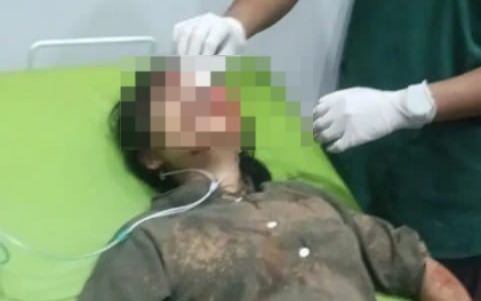 Warga Rantau Durian OKI Terjatuh Usai Diduga Dikejar Begal, Begini Kata Polisi