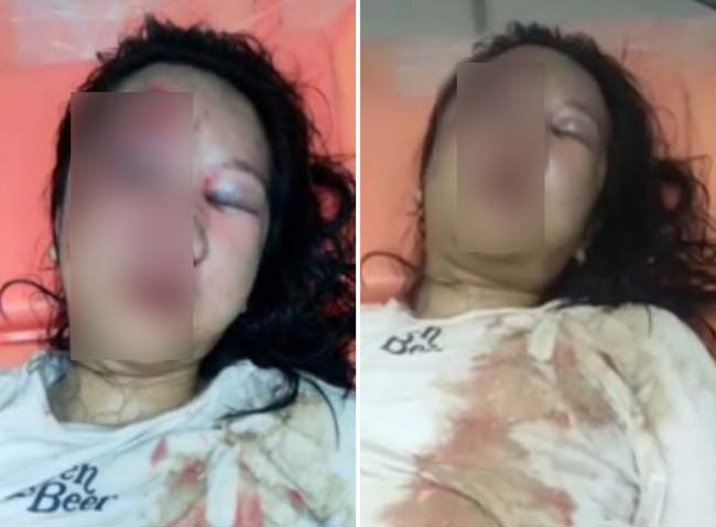 Anak Perempuan di Lubuklinggau Dianiaya Bapak hingga Babak Belur, Polisi Bergerak 