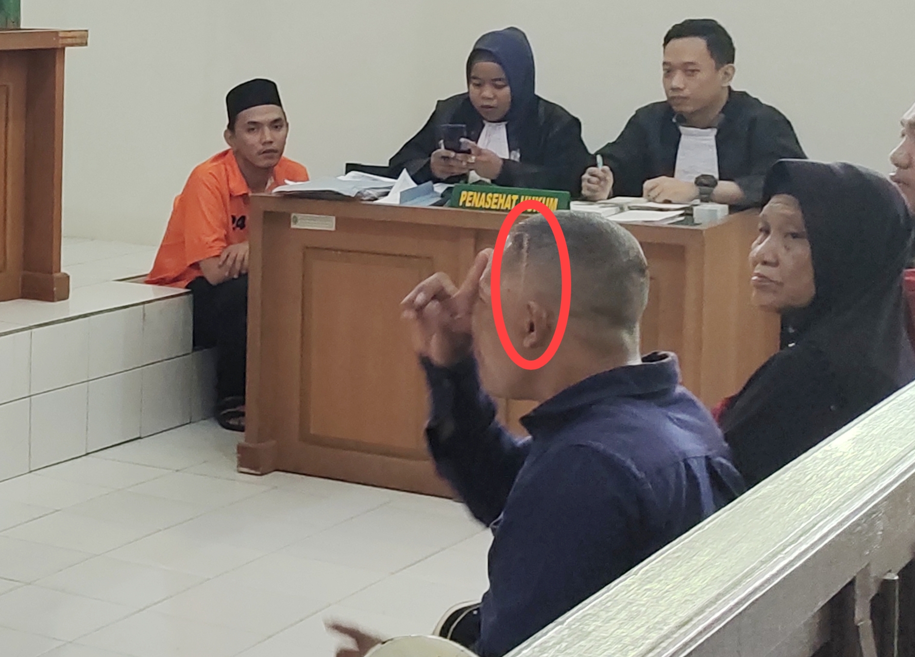 Fotografer Amatir Ini Dianiaya Rekan Seprofesi Alami Remuk Bagian Kepala, Minta Terdakwa Dihukum Setimpal