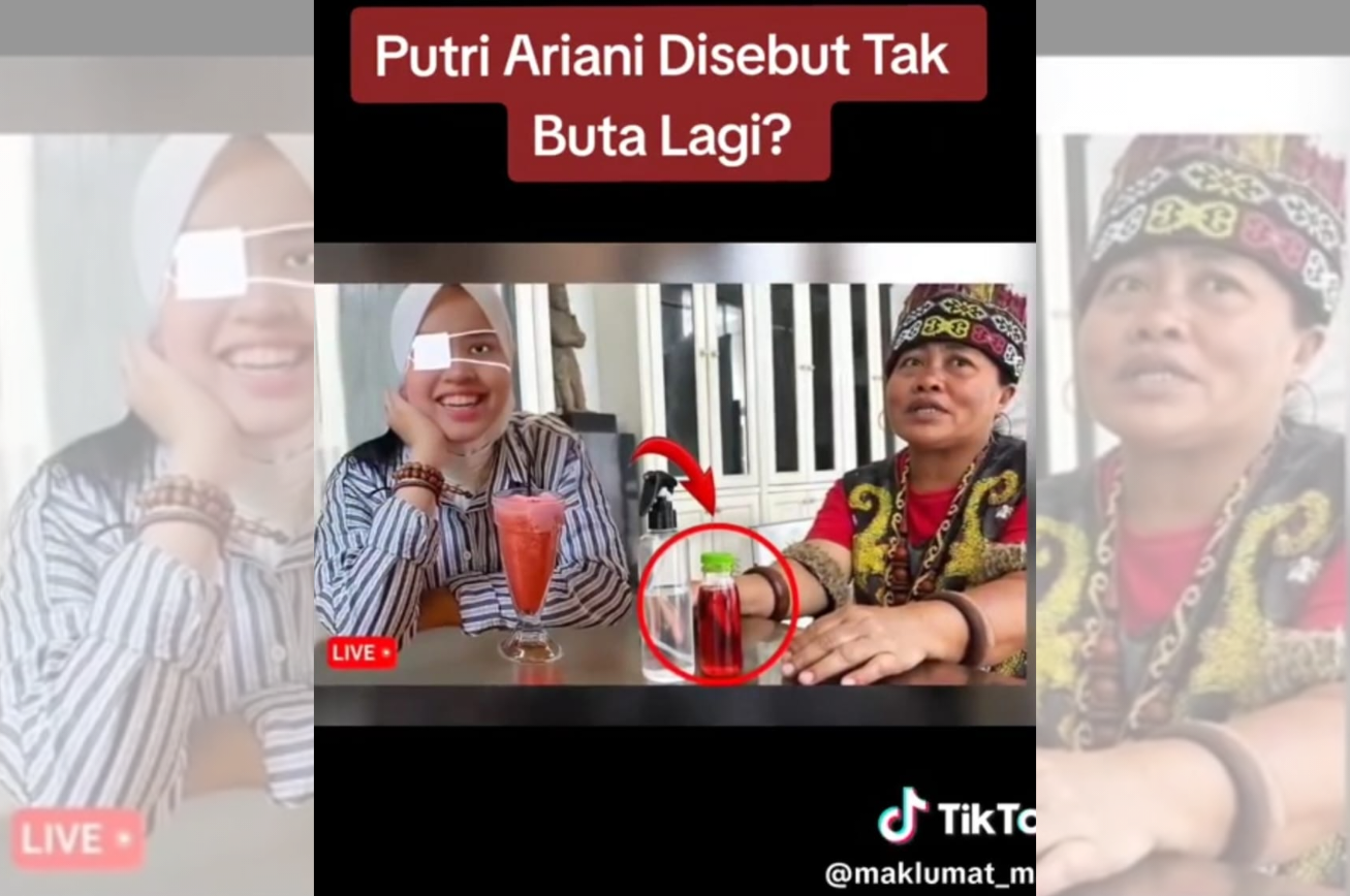 MASYAALLAH! Gara-Gara Minyak Bintang Ida Dayak, Putri Ariani Disebut Tak Buta Lagi