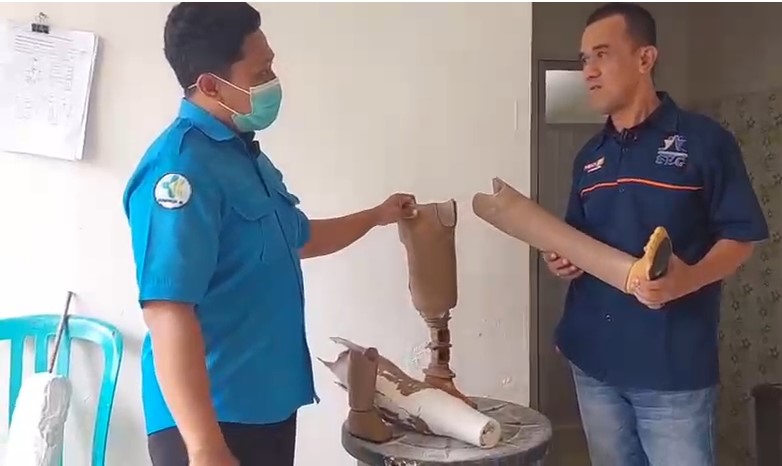 Unit Ortotik Prostetik RSUP dr. Rivai Abdullah Palembang Bisa Selesaikan 10 Kaki Palsu Per Tahun