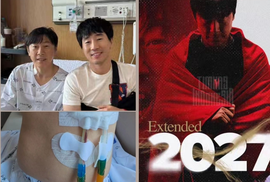 Kondisi Shin Tae-yong Pasca Operasi 6 Jam,  Siap untuk Kualifikasi Piala Dunia 2026