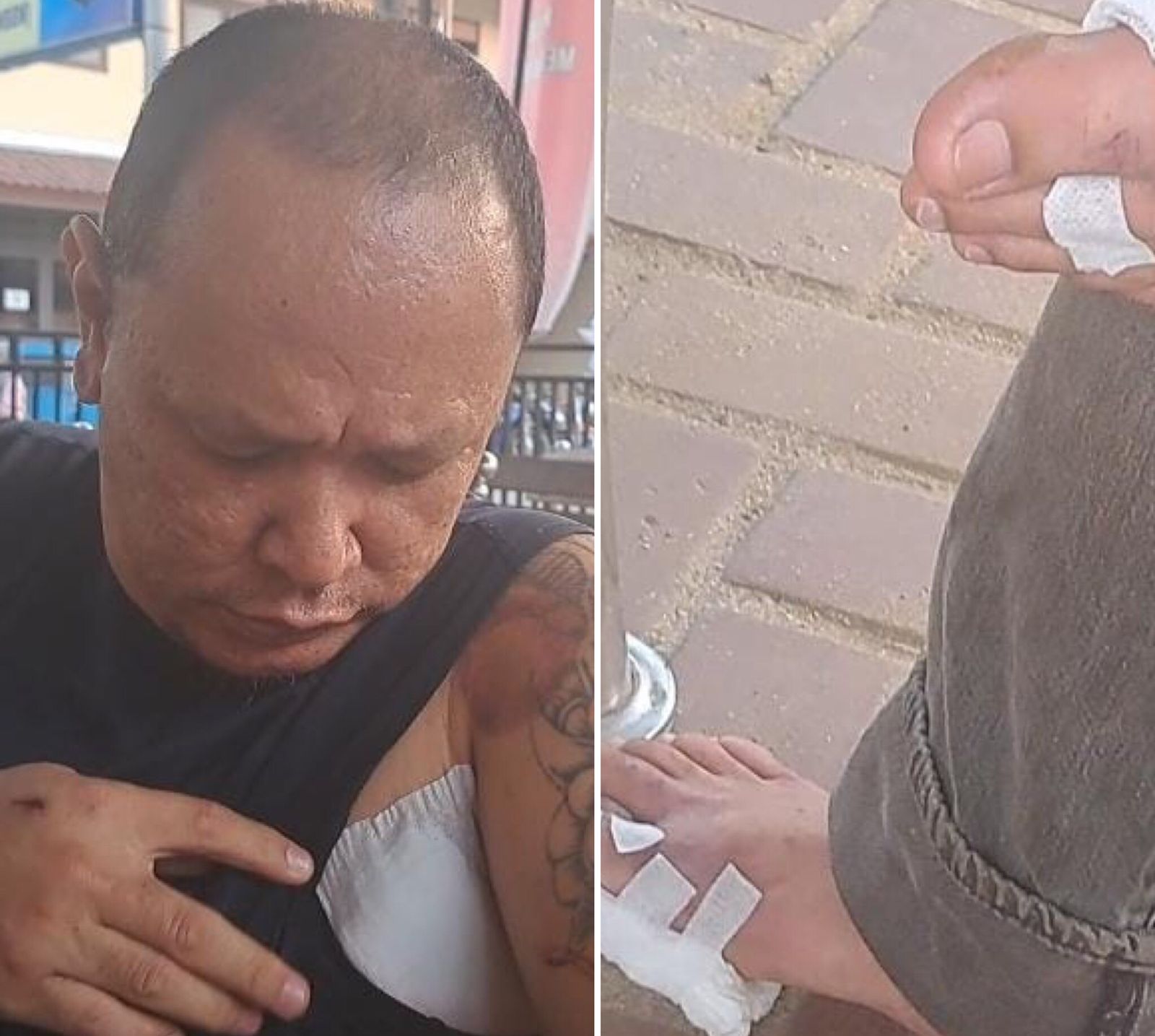 Tanpa Sebab, Pria di Palembang Diserang 5 Orang dengan Pisau Saat Pulang Salat Jumat