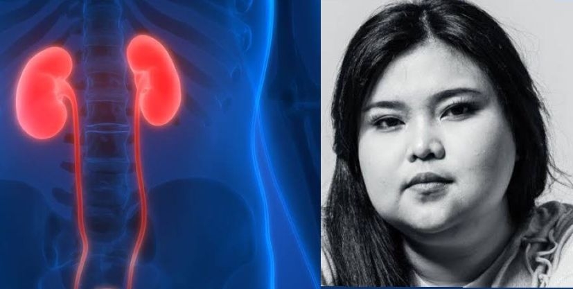 Mengenal Apa Itu Penyakit Lupus Nefritis yang Sebabkan Penyanyi Shena Malsiana Meninggal Dunia