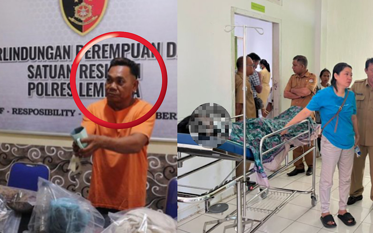 Alamak, Om Charles Siram Siswi SMP Dengan Air Keras Lantaran Cintanya Ditolak, Aksinya Terencana Sangat Matang