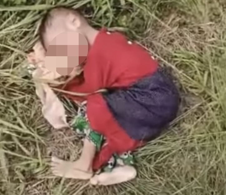 Miris! Bocah Perempuan 3 Tahun Penderita Gizi Buruk, Ditemukan Tergeletak Tak Berdaya di Semak-Semak