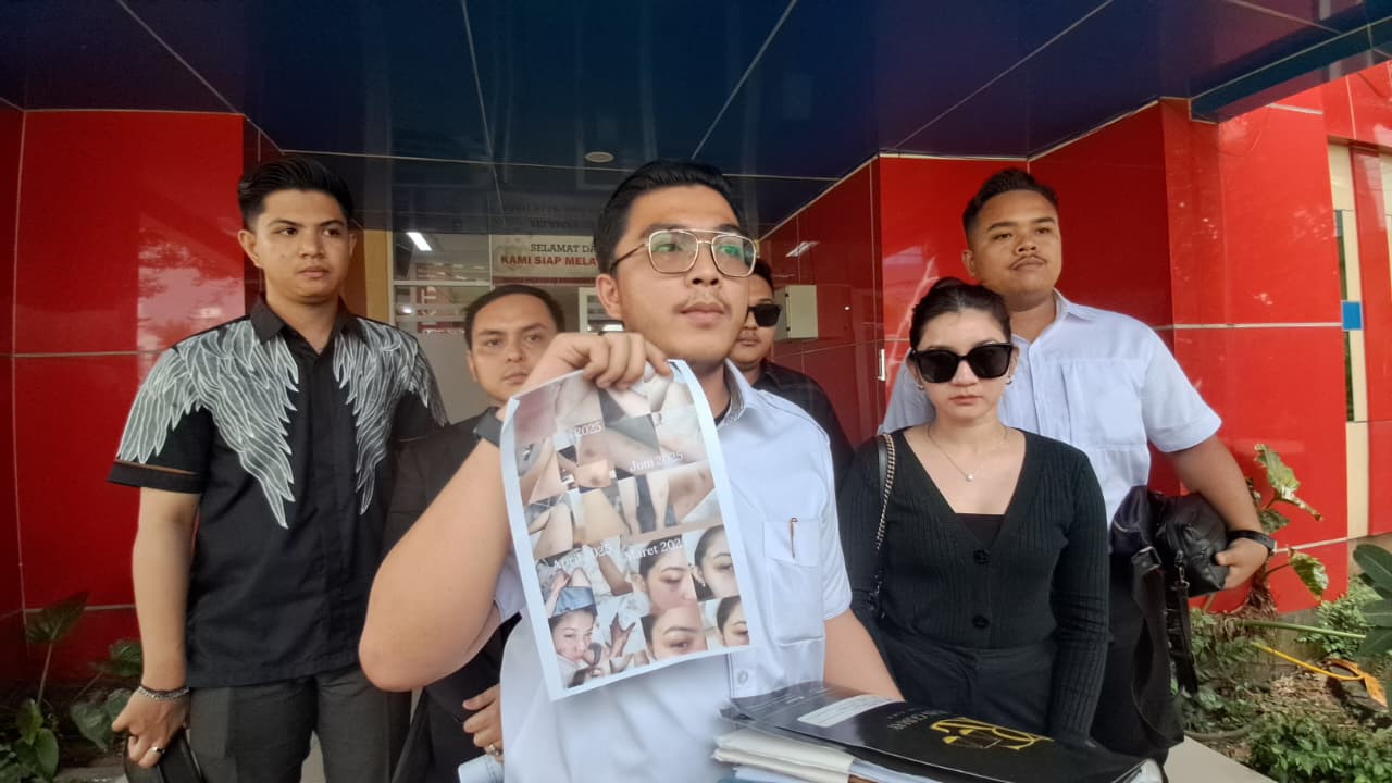 Selebgram Cantik di Palembang Korban Penganiayaan hingga Diancam Pistol, Pelaku Diduga Anak Pengusaha 