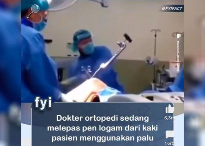 Merinding! Doktor Ortopedi Sedang Lepas Pen Logam di Kaki Pasien Menggunakan Palu