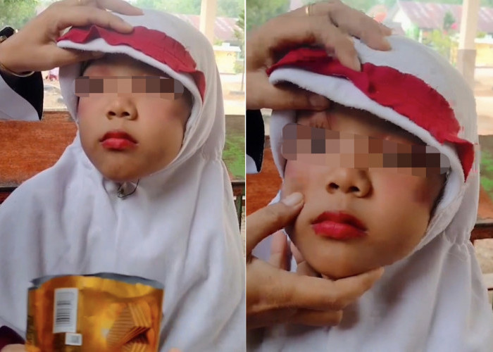 Viral! Bocah SD di Ogan Ilir Diduga Jadi Korban Kekerasan Ibu Kandung, Wajah Penuh Lebam