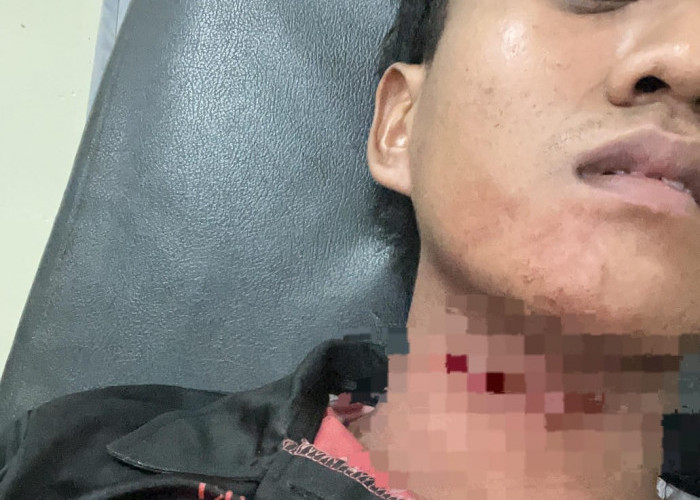 Leher Kena Tali Layangan Melintas di Jembatan Musi VI Palembang, Atlet Karate Butuh Donatur Biaya Operasi 