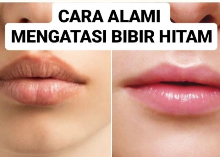 Bibir Gelap? Ini 9 Cara Alami Mengatasi  Bibir Hitam Paling Ampuh, Bikin Cerah! 