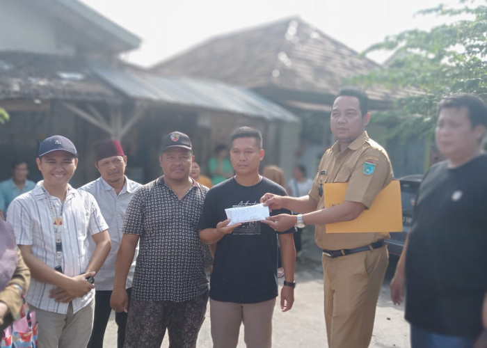 Bocah Penderita Tumor Mata Asal Tanjung Raja Ogan Ilir Kini Jalani Perawatan di RSMH Palembang