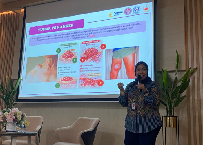 Peringati Hari Kanker Sedunia, RS Siloam Sriwijaya Gelar Edukasi Deteksi Dini Lewat Sharing Session Edukasi