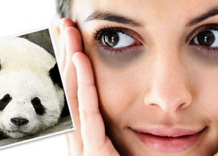 5 Tips Memudarkan Mata Panda Tanpa ke Klinik Kecantikan, Dijamin Ampuh Hilangkah Efek Hitam Bawah Mata
