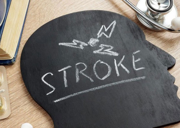Bocah 4 Tahun di Skotlandia Terserang Stroke, ini Gejalanya