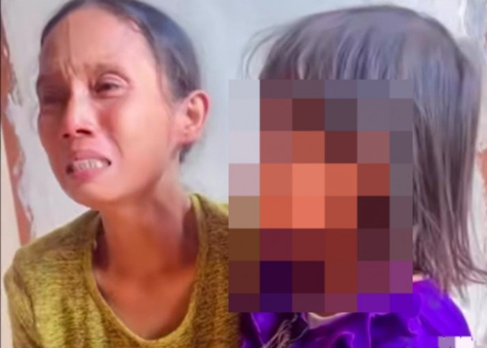 Bocah SD di Palembang Trauma Diduga Dianiaya di Sekolah, Mata Lebam Merah, Pelaku Bu Guru Pakai Cincin 