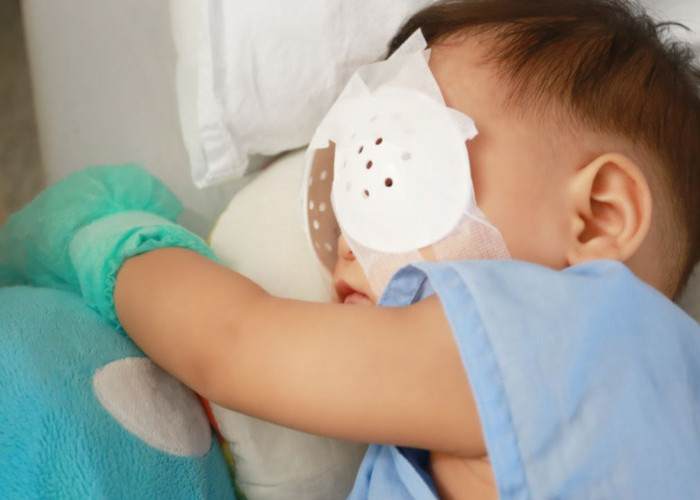 Waspada Katarak pada Bayi Baru Lahir, Kenali Gejala yang Perlu Operasi Segera