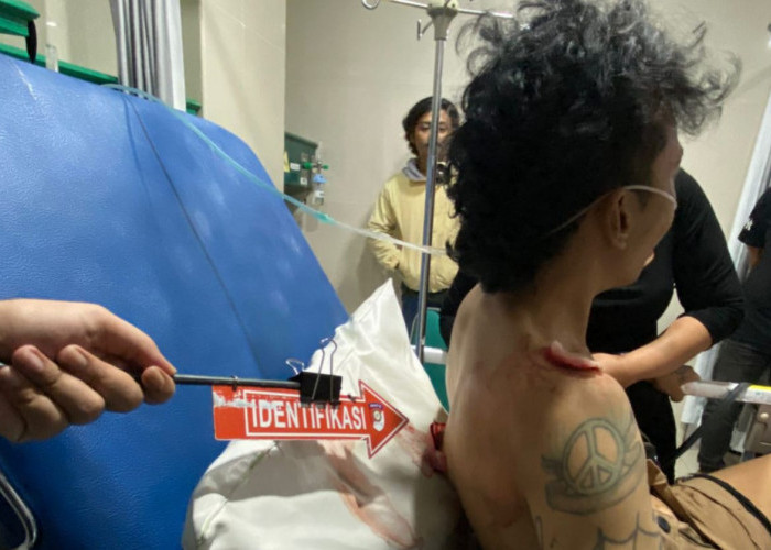 Dituduh Curi Hp Saat Nongkrong, Pria di Palembang Ini Tusuk 2 Teman Sekaligus 