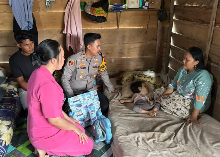 Menyentuh Hati, Polsek Babat Supat Bantu Anak Penderita Hidrosefalus Jelang Hari Bhayangkara ke-80
