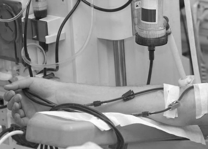 Pasien Gagal Ginjal Bisa Gunakan BPJS Kesehatan untuk Cuci Darah di Rumah Sakit 