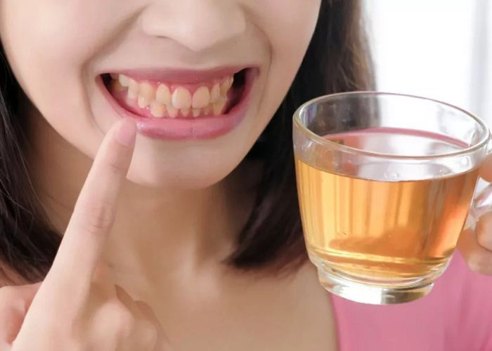 Benarkah Sering Minum Teh Bikin Gigi Jadi Kuning? Cek Faktanya Disini