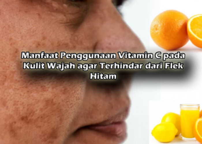 Manfaat Penggunaan Vitamin C pada Kulit Wajah agar Terhindar dari Flek Hitam