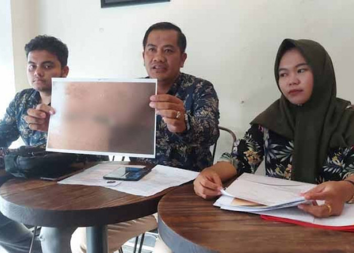 Pasca Operasi Usus Buntu, Perut dan Organ Sensitif Pelajar SMP di Palembang Membusuk 