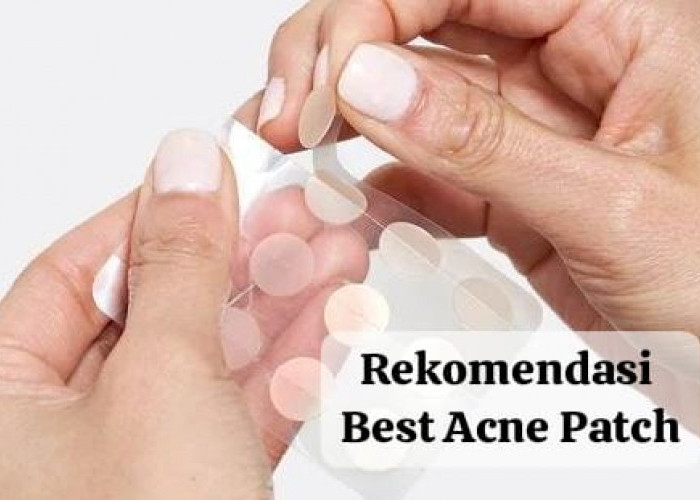 Bye-Bye Jerawat! 4 Rekomendasi Best Acne Patch Terampuh Atasi Jerawat yang Lagi Mateng