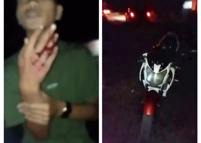 Jalan Rusak di Tanjung Batu Ogan Ilir Makan Korban, Pengendara Motor Kecelakaan Tunggal, Jari Manis Putus