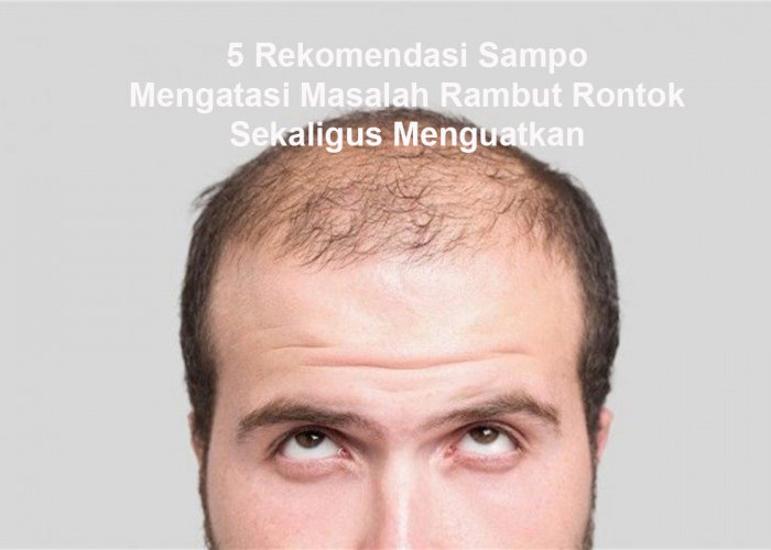  Ini 5 Rekomendasi Sampo yang Bisa Mengatasi Masalah Rambut Rontok Sekaligus Menguatkan