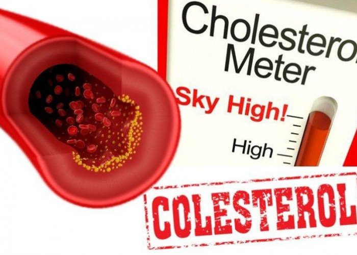 Mengenal Kolesterol, Benarkah Sebagai Biang Penyakit Berbahaya Bagi Tubuh?