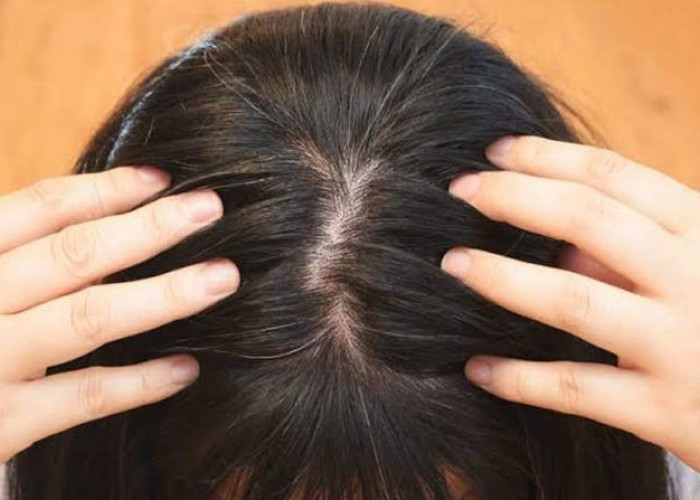  Yuk Intip 5 Tips Sederhana Ini untuk Mencegah Rambut Beruban di Usia Muda 