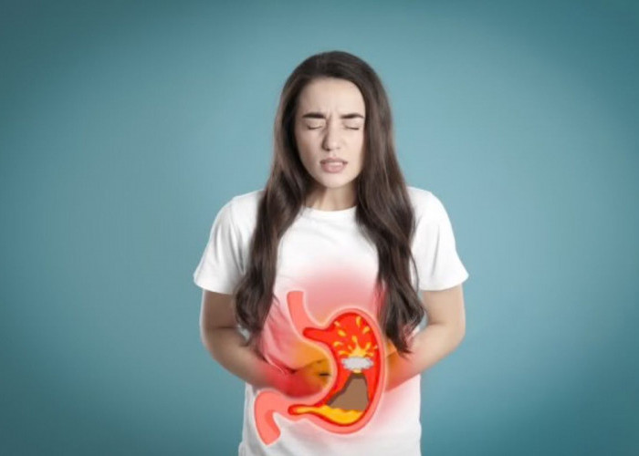 Asam Lambung Sering Naik? Ini Tips Mengatasinya dan Kenali Gejala yang Wajib Diketahui